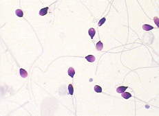 Morphologie du sperme BRED-015 souillant la méthode de Kit Diff Quik Rapid Staining