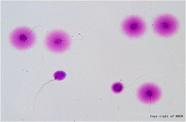 Test de fragmentation de l' ADN du sperme BRED 24 mois