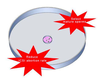 Le plat de sélection de sperme d'acide hyaluronique pour ICSI IVF réduisent le taux de perte de grossesse
