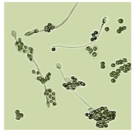 Kit masculin d'essai de la fertilité BRED-011 pour le diagnostic masculin de stérilité de spermatozoïdes de détermination