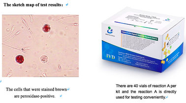Kit 40T/Kit d'essai de leucocytes d'échantillon de sperme pour le criblage masculin d'infection d'appareil reproducteur