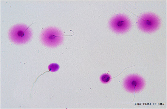 40T/Kit Kit de fragmentation de l'ADN du sperme avec méthode SCD et CE approuvé pour des tests précis de fragmentation de l'ADN